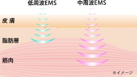 低周波EMSと中周波EMSのイメージイラスト
